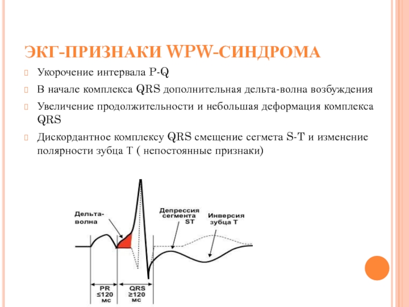 Волна возбуждения. Деформация комплекса QRS. Укороченный интервал PQ. Деформированный комплекс QRS на ЭКГ. Дискордантное смещение зубца т.