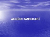 AKCİĞER KANSERLERİ
