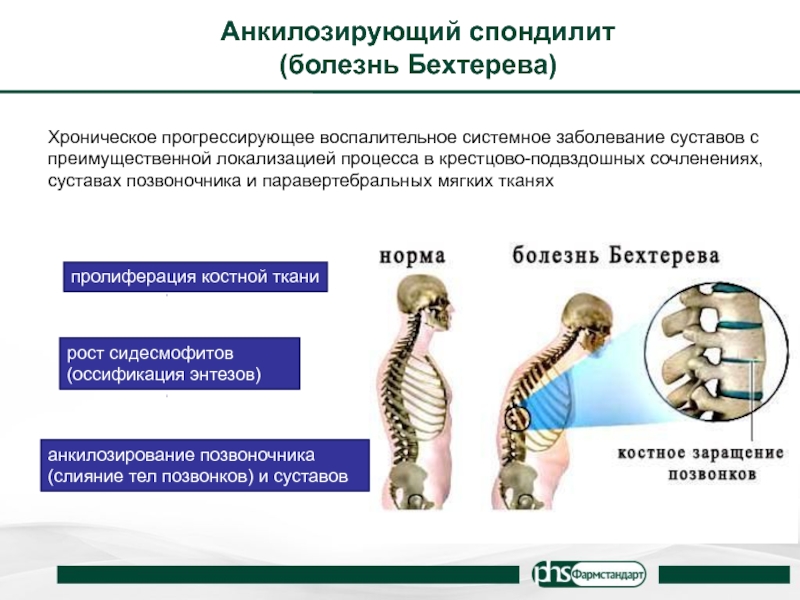 Школа для пациентов с заболеваниями суставов и позвоночника презентация