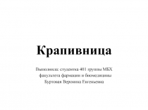 Крапивница