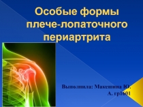 Особые формы плече-лопаточного периартрита