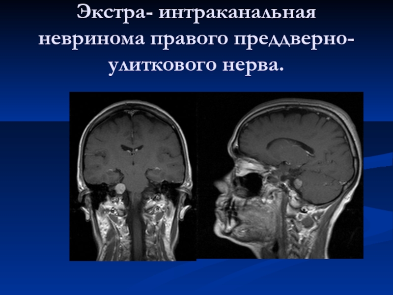 Реферат: Магнитно-резонансная томография в диагностике опухолей головного мозга