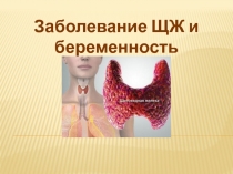 Заболевание ЩЖ и беременность