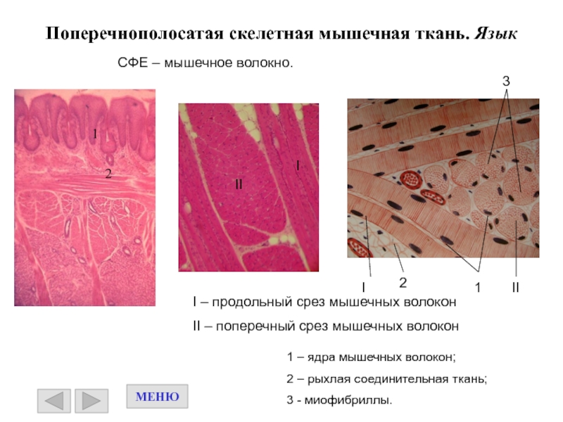 Поперечно полосатая мышечная ткань рисунок