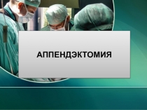 Аппендэктомия