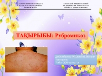 С.Ж.АСФЕНДИЯРОВ АТЫНДАҒЫ
ҚАЗАҚ ҰЛТТЫҚ МЕДИЦИНА УНИВЕРСИТЕТІ
КАЗАХСКИЙ