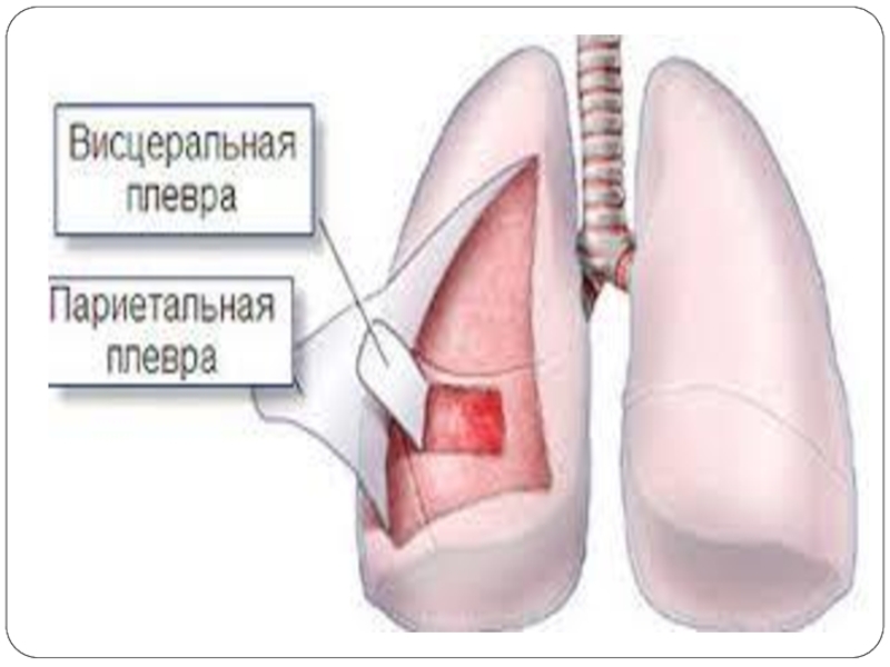 Где находится плевра у человека фото