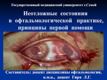 Неотложные состояния в офтальмологической практике, принципы первой помощи