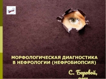 МОРФОЛОГИЧЕСКАЯ ДИАГНОСТИКА
В НЕФРОЛОГИИ (НЕФРОБИОПСИЯ)
С. Боровой, 2011