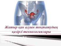 Жатыр қан ағуын тоқтатудың қазіргі технологиялары