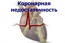 Коронарная
недостаточность
Посвящается Е.Н. Торопыгиной
