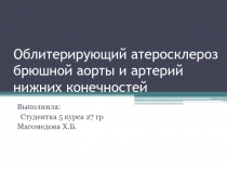 Облитерирующий атеросклероз брюшной аорты и артерий нижних конечностей