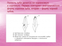 Полость зуба делится на коронковую и корневую. Первая повторяет анатомическую