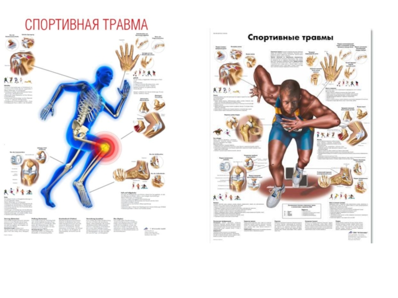 Спортивный массаж презентация