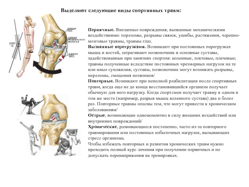 Реферат: Массаж коленного сустава при спортивных травмах