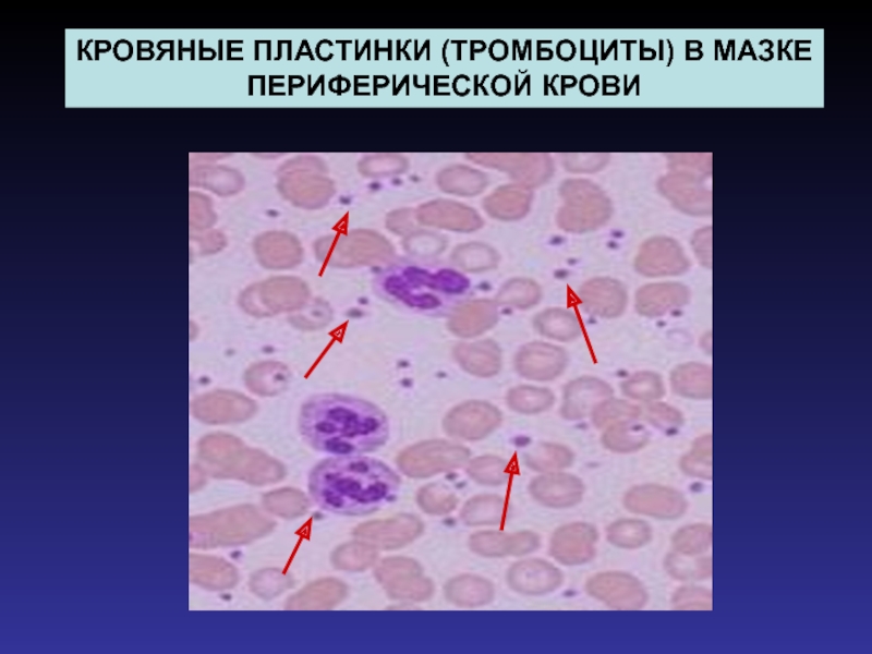 Тромбоциты в мазке крови фото