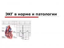ЭКГ в норме и патологии