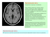 Протокольная часть:
Срединные структуры не смещены.
Кора и белое вещество