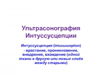Ультрасонография Интуссусцепции