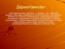 Дерматомиозит