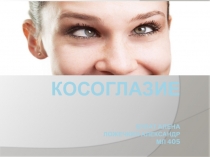 КОСОГЛАЗИЕ Булат Алена Ложечкин александр МЛ 405