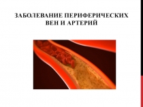 ЗАБОЛЕВАНИЕ ПЕРИФЕРИЧЕСКИХ ВЕН И АРТЕРИЙ