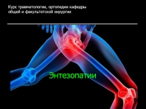 Энтезопатии
Курс травматологии, ортопедии кафедры общей и факультетской хирургии