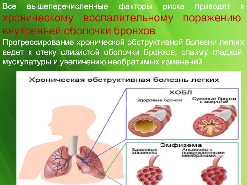 Внутреннее поражение. Факторы риска хронической обструктивной болезни легки. Методы профилактики ХОБЛ. Хронический обструктивный методы профилактики. Факторы риска хронического воспаления.