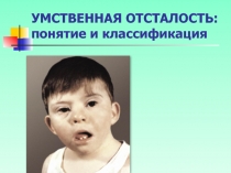 УМСТВЕННАЯ ОТСТАЛОСТЬ: понятие и классификация