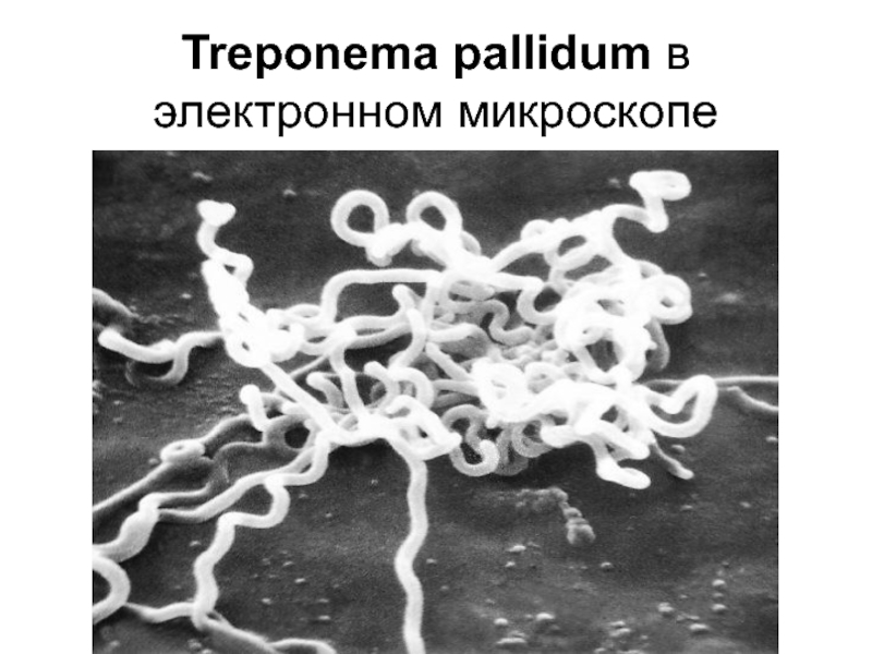 Бледная трепонема treponema pallidum. Бледная трепонема микроскоп. Трепонема паллидум микроскопия. Трепонема паллидум спирохета.