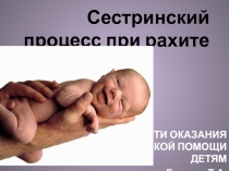 Сестринский процесс при рахите