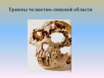 Травмы челюстно-лицевой области