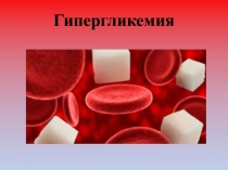 Гипергликемия