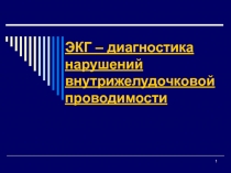 ЭКГ – диагностика нарушений внутрижелудочковой проводимости