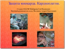 Защита миокарда. Кардиоплегия. Студент ОЛД 503 Жиборкин Глеб Вадимович Научный