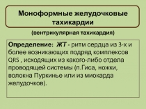 Моноформные желудочковые тахикардии