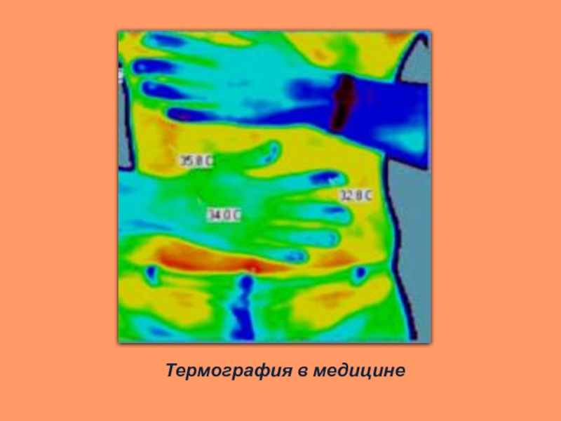 Медицинская термография презентация