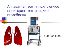 Аппаратная вентиляция легких: мониторинг вентиляции и газообмена