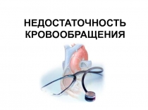 НЕДОСТАТОЧНОСТЬ КРОВООБРАЩЕНИЯ