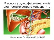 К вопросу о дифференциальной диагностике острого холецистита