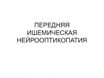 ПЕРЕДНЯЯ ИШЕМИЧЕСКАЯ НЕЙРООПТИКОПАТИЯ