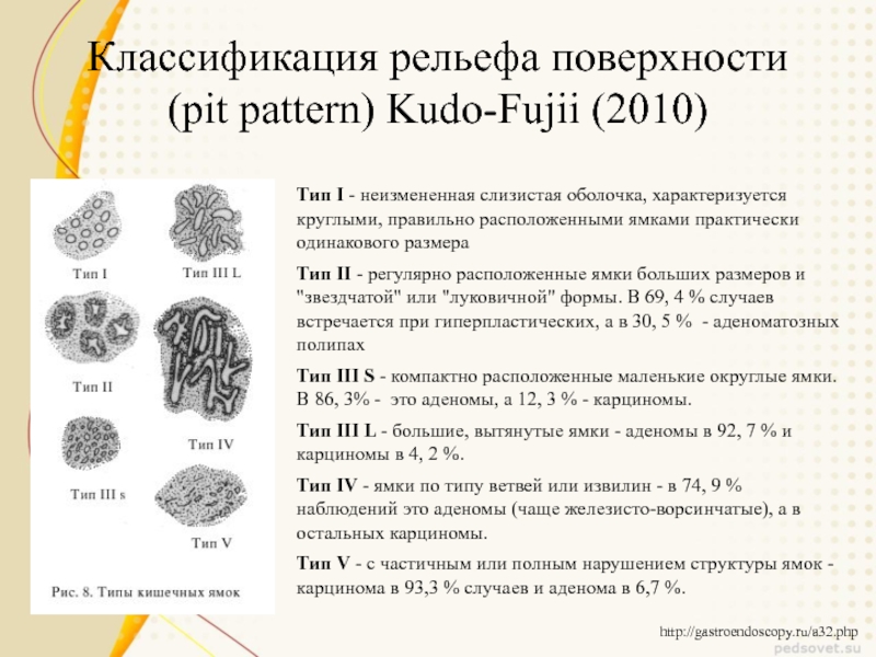 Ямочный рисунок по кудо