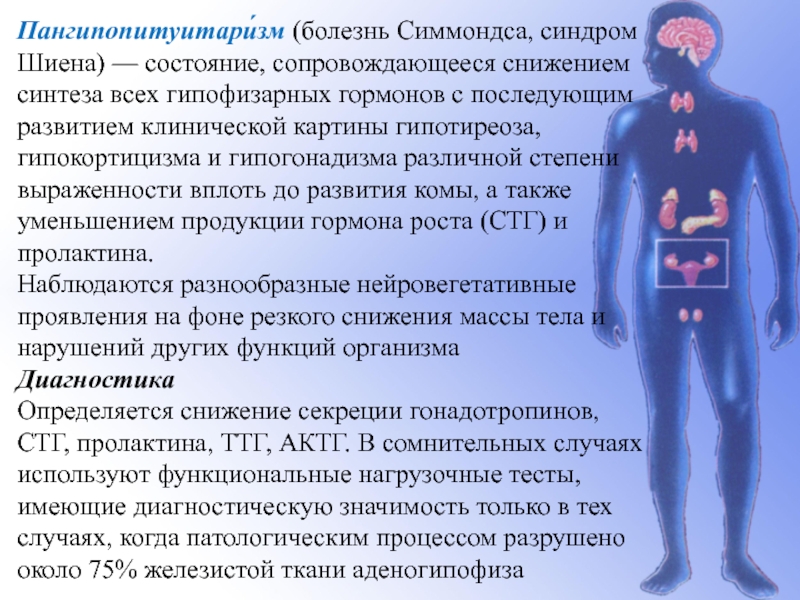 Синдром шиена презентация