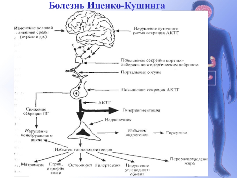 Синдром иценко кушинга презентация