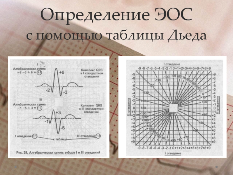 Эос экг картинки