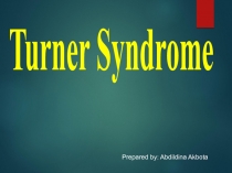 Turner Syndrome
Prepared by: Abdildina Akbota