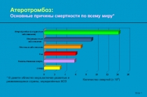 Slide 1
Атеротромбоз:
Основные причины смертности по всему миру*
* В девяти