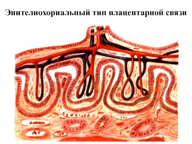 Типы плацент презентация