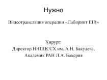 Нужно