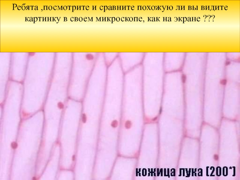 Лук под микроскопом 5 класс лабораторная. Строение кожицы лука под микроскопом. Кожица лука под микроскопом. Растительная клетка кожицы лука. Клетки лука под микроскопом.